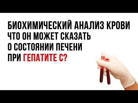 Биохимический анализ крови. Что он может сказать  о состоянии печени при гепатите С?
