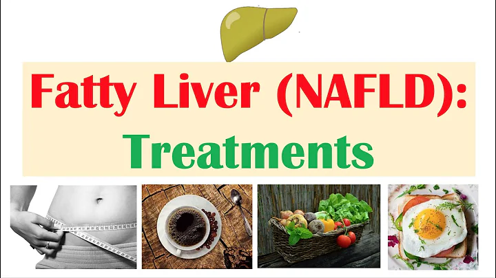 How to Treat & Reverse A Fatty Liver | Exercise & Diet Methods for Non-Alcoholic Fatty Liver Disease - DayDayNews