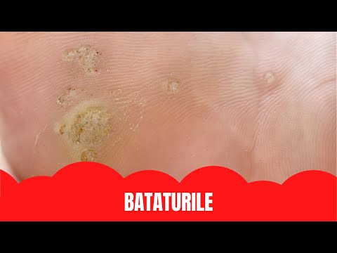 BATATURILE