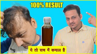 Hair oil for hair growth | My hair fall stopped in just 10 days| #hairtransplantkabir