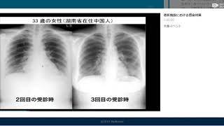 透析室における新型コロナウイルス対策　コビディエン