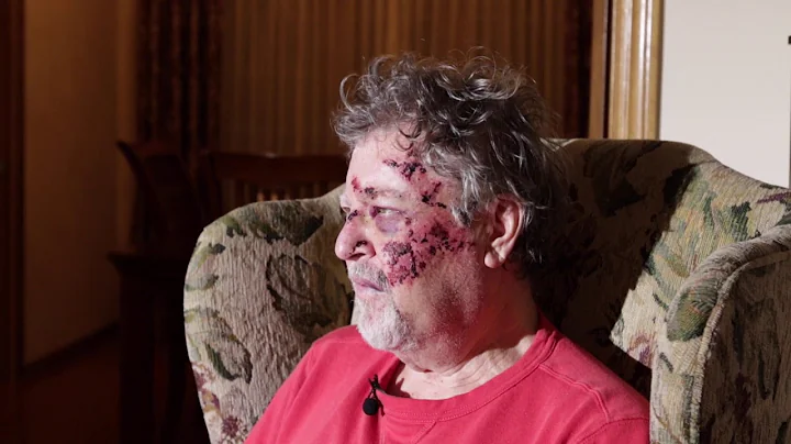 Richard Suter talks about abduction and beating