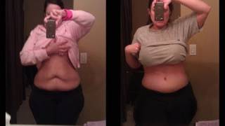 Video voorbeeld van "VLOG:  My new body!  (before and after tummy tuck and breast lift)"