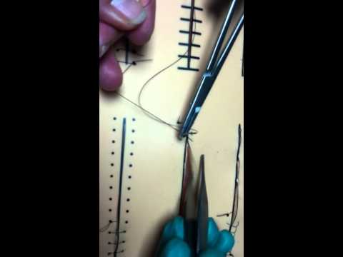 Suture KV continuous locking stitch