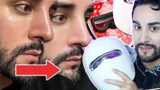 Download Lagu Why Makeup Looks Better on LED Mask-Treated Skin (Science + Results) MP3