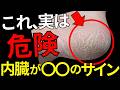 【乾燥ではなかった】踵のガサガサは内臓からのSOSサイン!隠れた病気を徹底解説