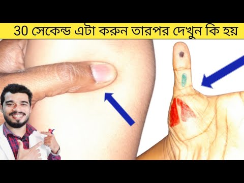 ভিডিও: ঠান্ডা লাগলে ব্যায়াম করার ays টি উপায়