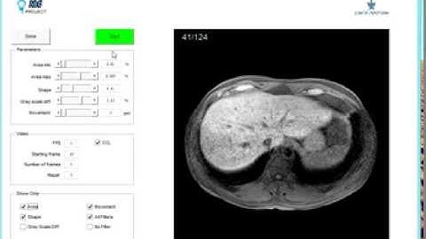 I&G Project 4.9.13 - DICOM on Matlab