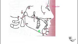 Cephalometrics Part 1 screenshot 5