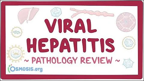 Viral hepatitis: Pathology Review - DayDayNews