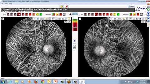 RHA Pioneer Webinar 01