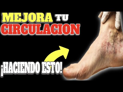 Video: 3 formas de saber si se tuerce la rodilla