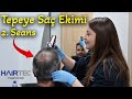 Saç Ekimi 2. Seası da Atlattık, 1. ile 2. Arasında Fark Var Mı? | Japonic