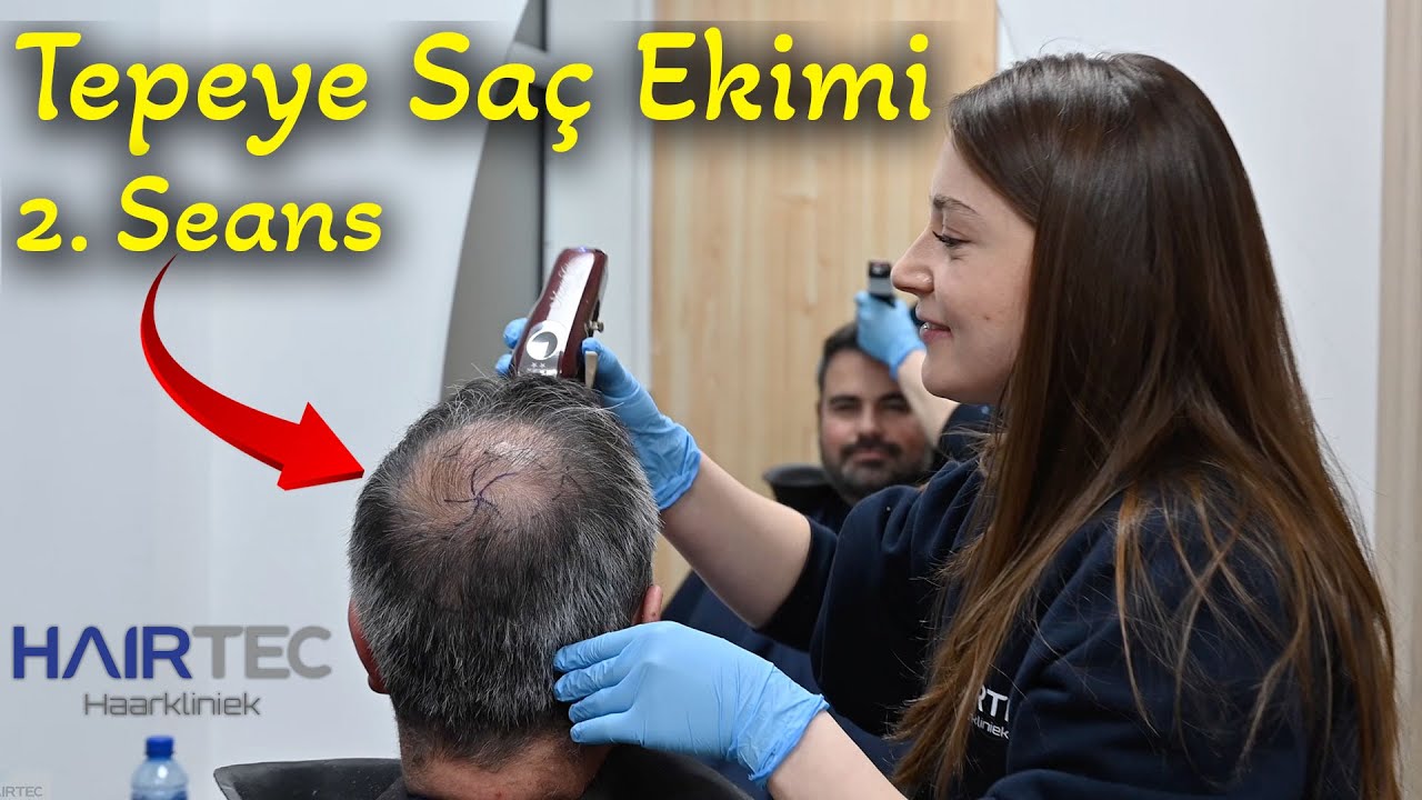 Saç Ekimi 2. Seası da Atlattık, 1. ile 2. Arasında Fark Var Mı? | Japonic