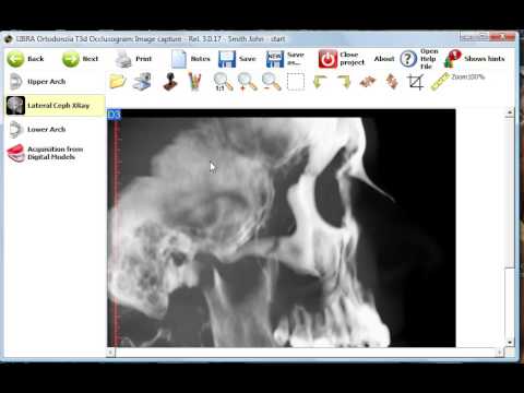 Image acquisition.wmv