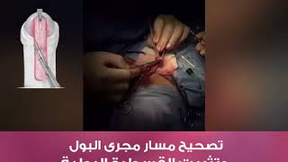 الاحليل التحتي