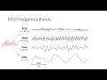 EEG Signal Processing