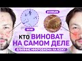 Пробиотики в косметике. Как микробиом влияет на кожу?