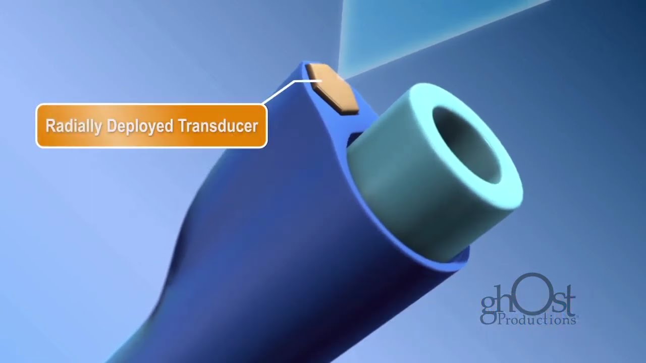 Ghost Productions TE Connectivity Medical Ultra Device YouTube