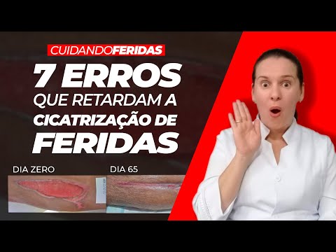 Vídeo: O Modelo Foi Esfolado E Sangrado