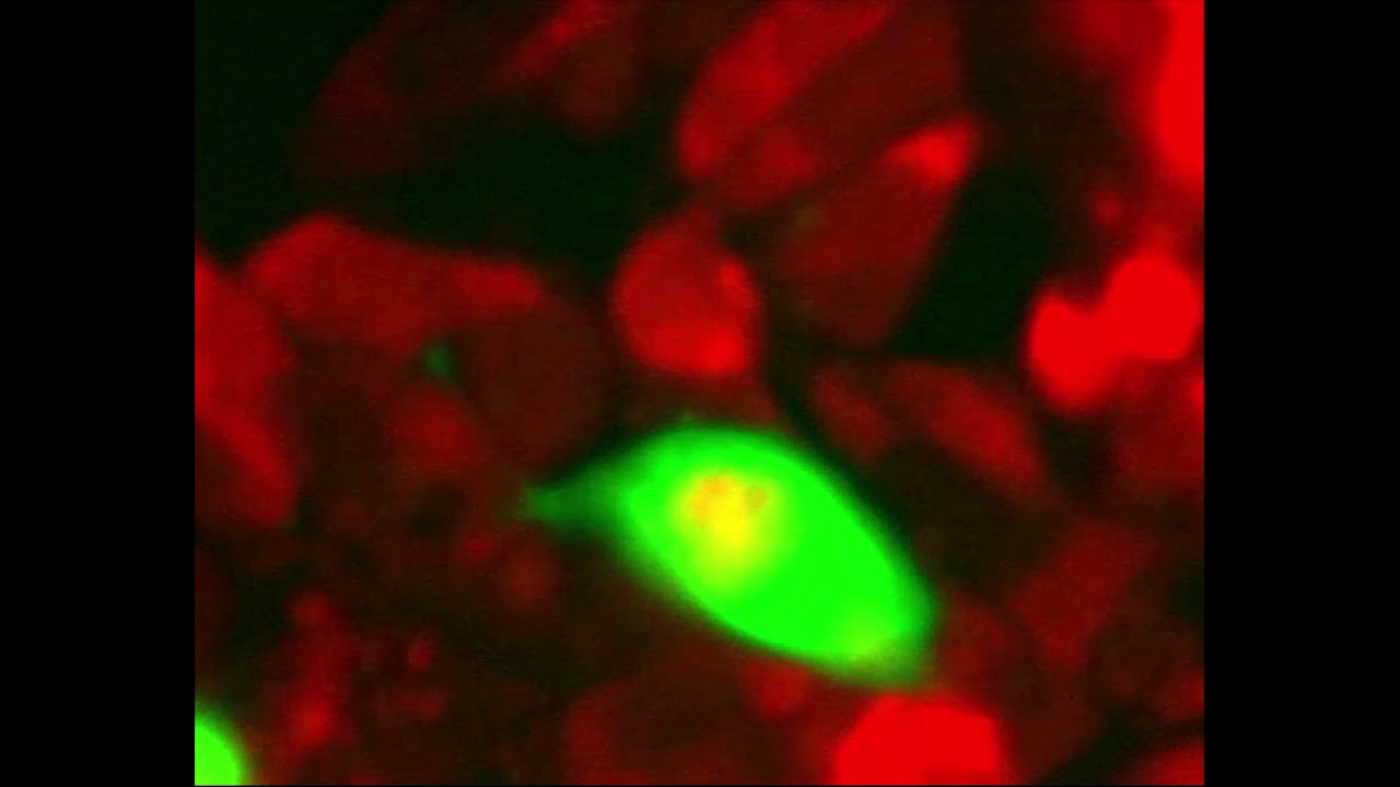 Для улучшения выживаемости раковые клетки могут пожирать себе подобных. Почему раковые клетки уничтожают своих «собратьев»? Фото.