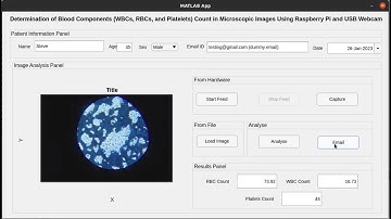 Determination of Blood count in Microscopic images using Raspberry Pi and USB Webcam