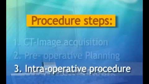 Mazor Robotic Surgery System, produced by Virtual Point