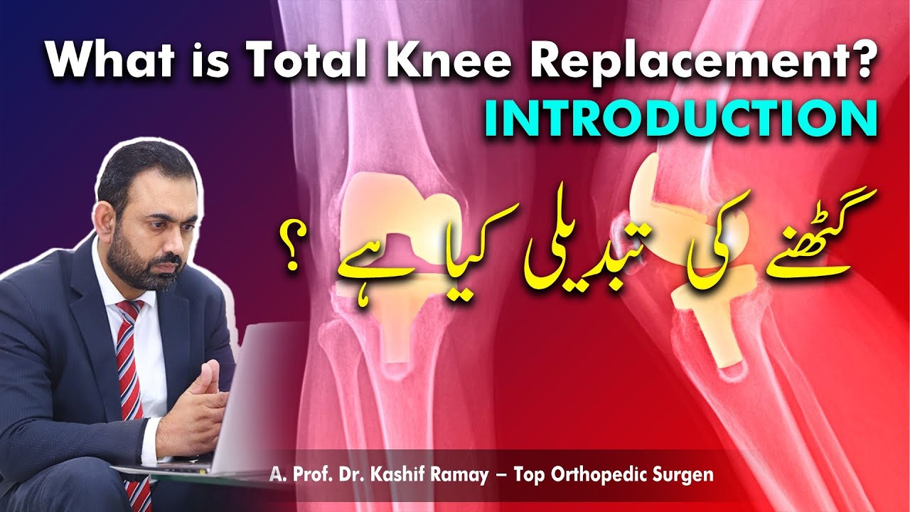 82 What is Total Knee Replacement? INTRODUCTION Urdu/Hindi Dr