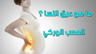 ما هو عرق النسا ؟ | عرق النسا اسبابه وعلاجه