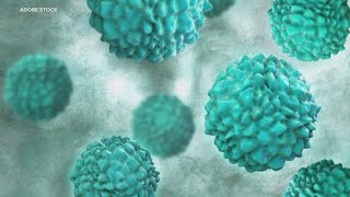 Norovirus cases spiking in U.S.