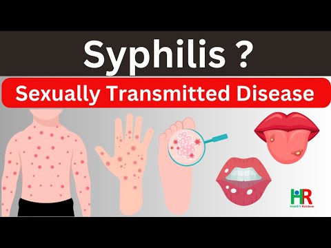 वीडियो: सिफिलिस के लक्षण कब प्रकट होते हैं?