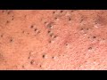 Blackhead is a great