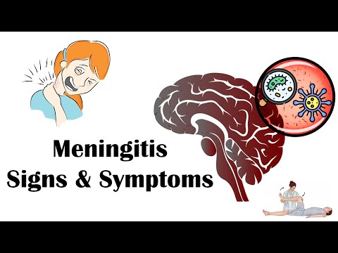 Meningitis - Signs