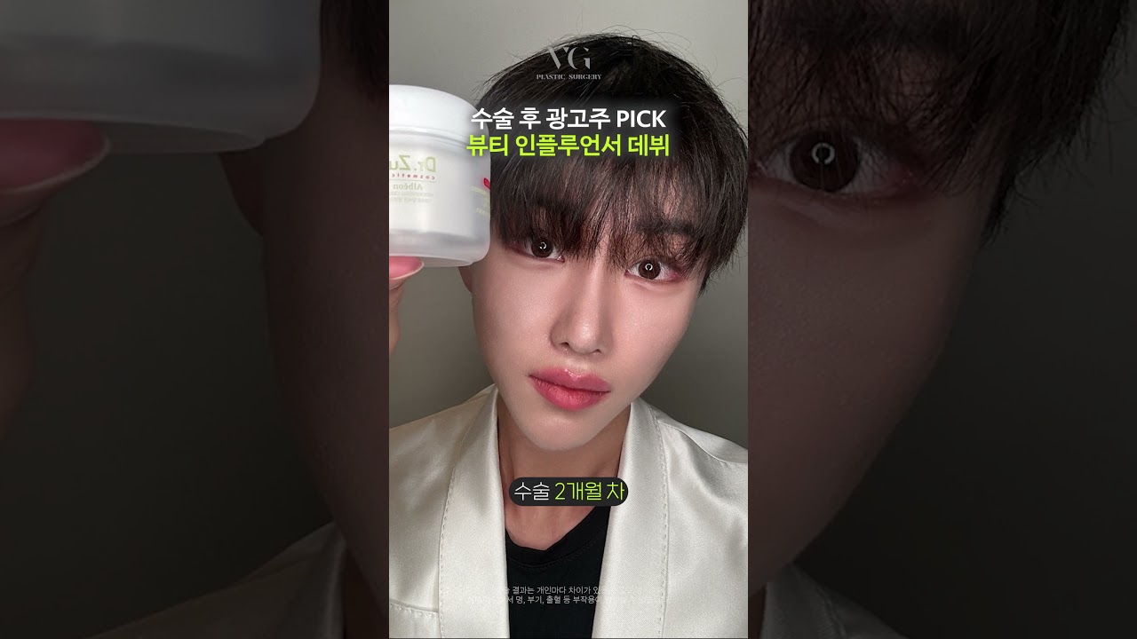 [貝瑞好整形外科診所] 從手術後到模特兒出道。#鼻整形 #臉部輪廓 #男性眼部整形