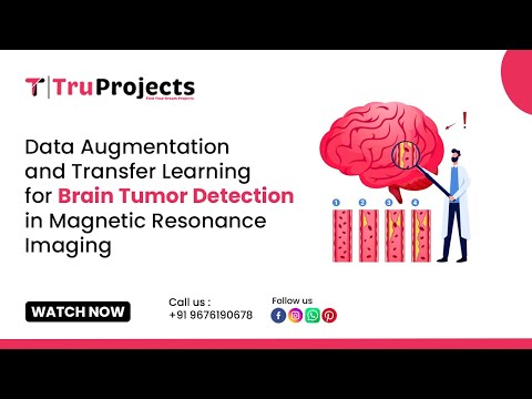 Data Augmentation and Transfer learning for Brain Tumor Detection in magnetic Resonance imaging