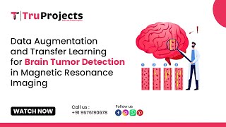 Famous Data Augmentation and Transfer learning for Brain Tumor Detection in magnetic Resonance imaging Wealth