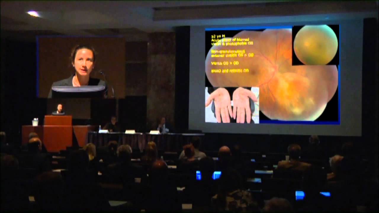 Uveitis Causes Symptoms And Pictures