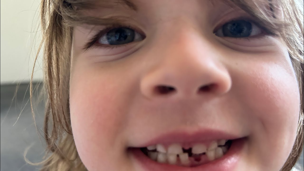 Pia lost her first TOOTH 🦷!!!