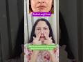 Reduce Laugh Lines #shorts #trending #ytshorts #faceyoga #facemassage #trendingaudio