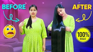 अगर मैं ये Trick ना करती तो पूरी गंजी हो जाती ‍♀ Hairfall se Bachane ke liye ye Trick Zarur Kare