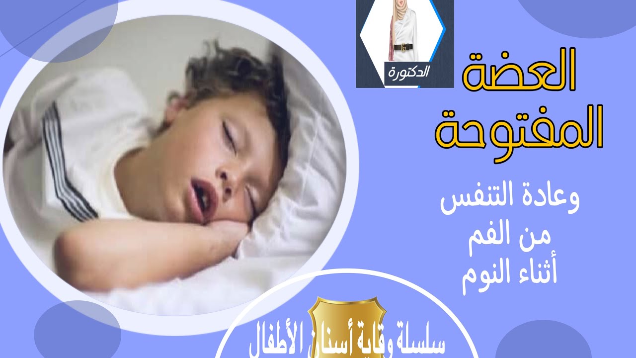 التنفس من الفم أثناء النوم و تأثيره على أسنان الأطفال