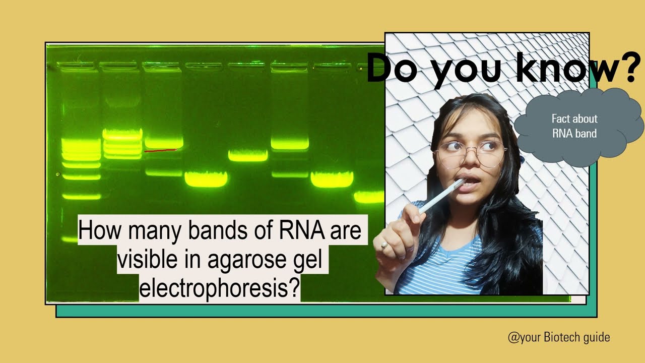 How to interpret RNA BANDS in agarose gel electrophoresis?