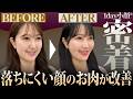 落ちづらいお顔のもたつきを解消！フェイスラインが綺麗になる1day小顔®︎の経過と実際の効果とは？