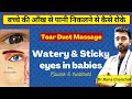 Sticky eyes in babies: Causes & treatment || Tear duct (NLD) Massage