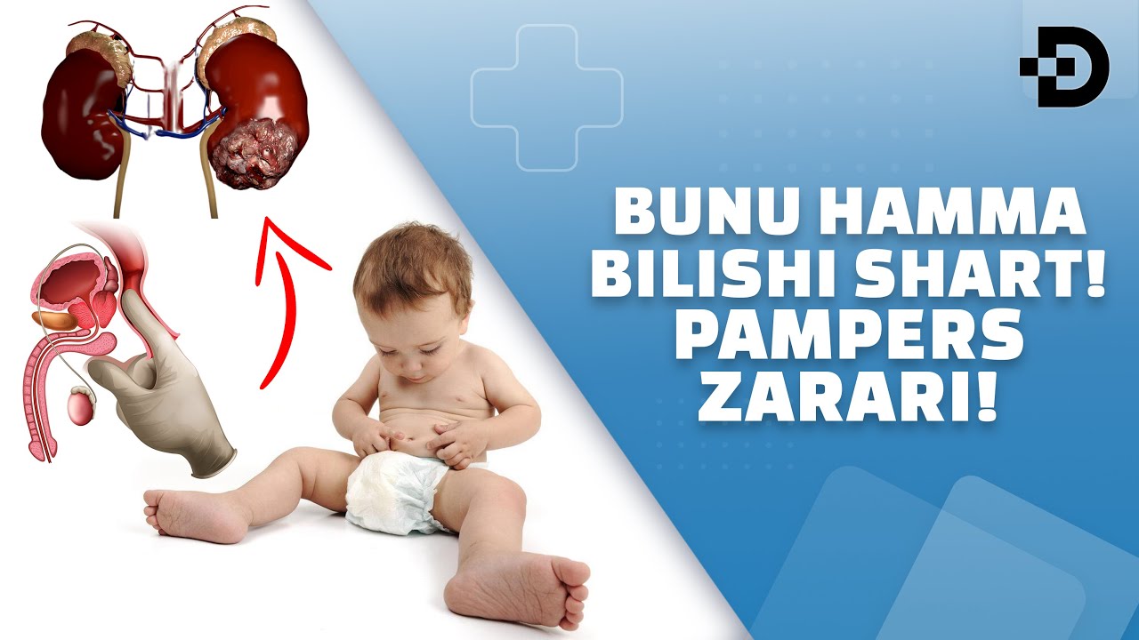 БОЛАГА ХАР КУН ПАМПЕРС КИЙДИРСА НИМАЛАР БЎЛИШИНИ КЎРИНГ! ПАМПЕРС ЗАРАРИ!