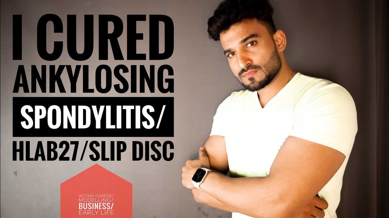 Total Cost Of 1 Time Panchakarma In Patanjali Yogpeeth Cure As Cure Hlab27 Positive Youtube