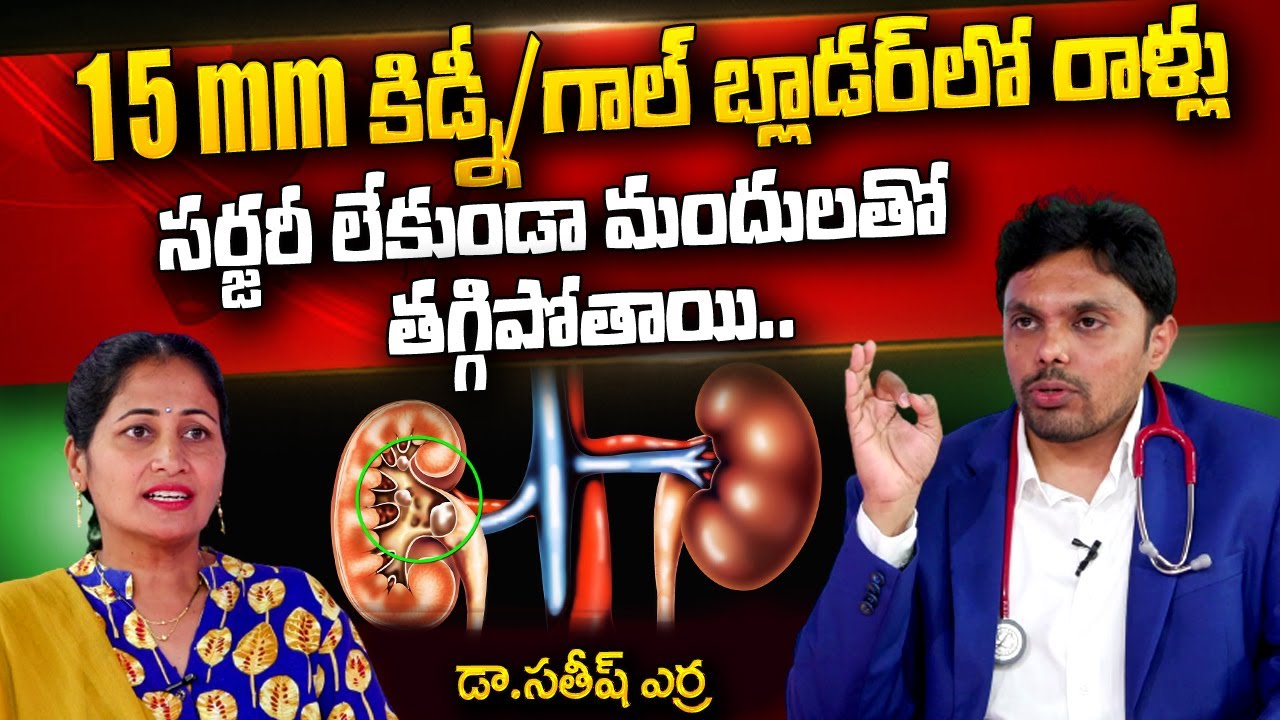 కిడ్నీ/గాల్ బ్లాడర్ లో రాళ్ళు సర్జరీ లేకుండానే తగ్గిపోతాయి | Remove Kidney Stones | Dr.Satish Erra