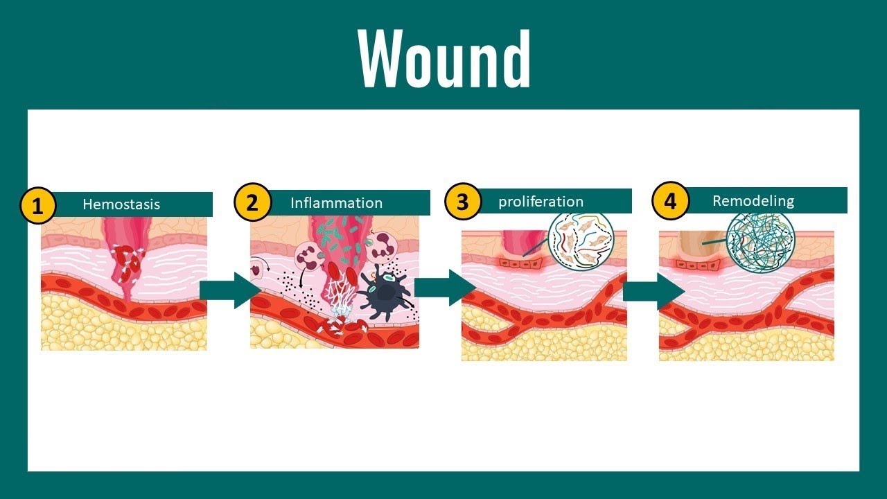 Toxicology & Forensic Round - Wound - YouTube