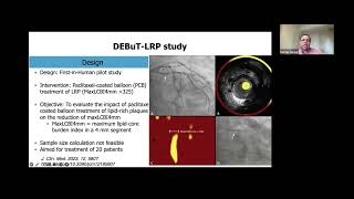 Best Practices for the Use of Coronary Imaging and Physiology for DCB Interventions - Hector Garcia
