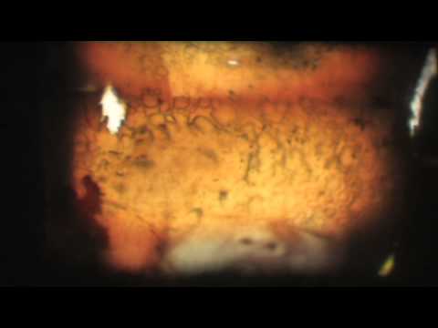 Light-sleep (Félálom)